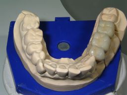 Die 3 Kronen auf dem Gipsmodell